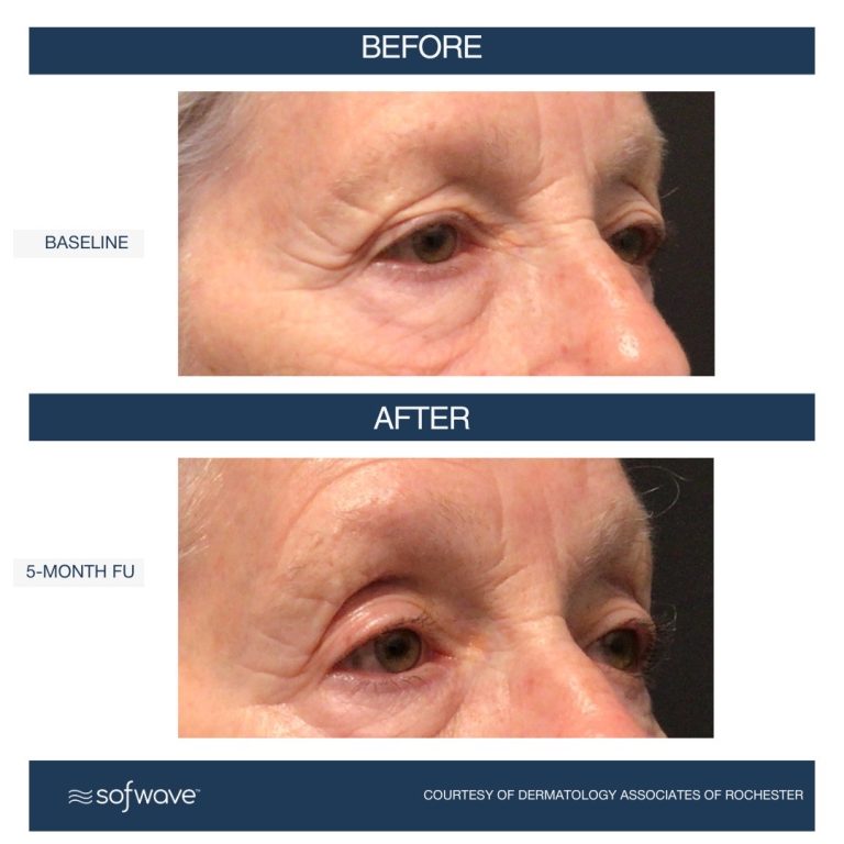 Set 67 Eyebrow 768x768