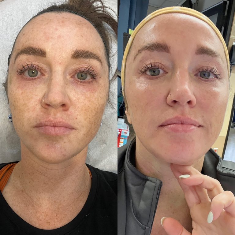 pico deep fractional 768x768